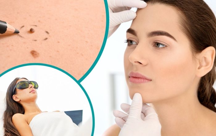 Dermatóloga en Tecámac, EDOMEX - Dra Lizeth Sánchez