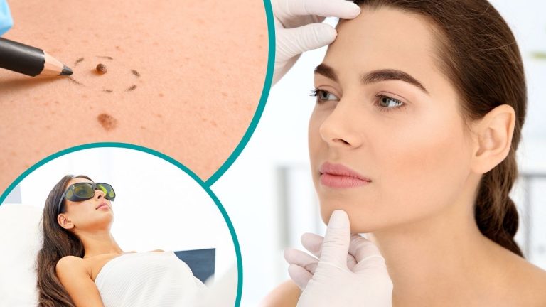 Dermatóloga en Tecámac, EDOMEX - Dra Lizeth Sánchez